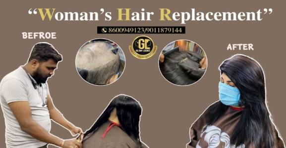 Hair Replacement