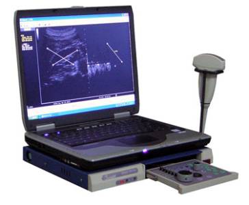 Ethiroli Tiny 16a