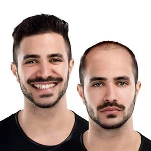 Stick-On Hair Systems