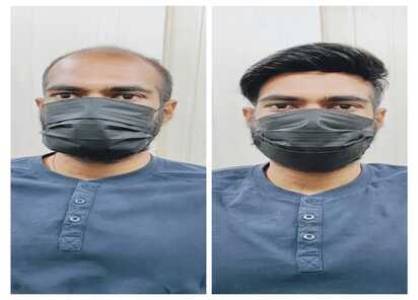 Hair Transplant