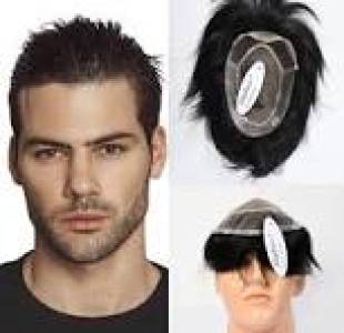 Hair patch