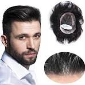 Hair Patch