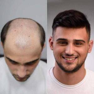 Hair Weaving