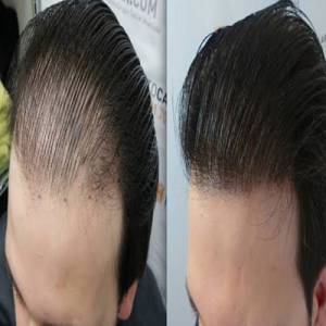 Hair Weaving