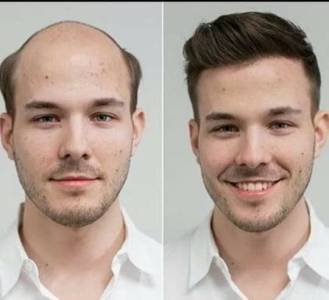 Hair Wigs