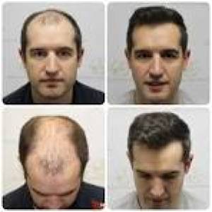 HAIR WIGS