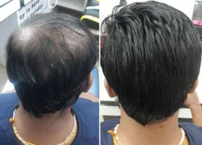 Hair Weaving