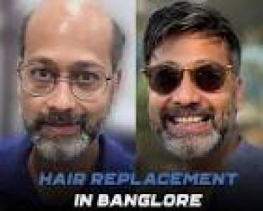 BEST HAIR PATCH IN BANGALORE