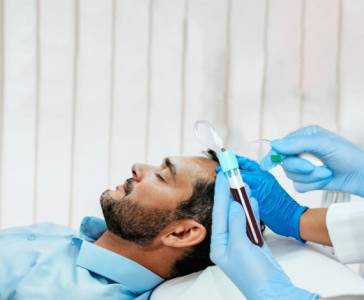 PRP Treatment