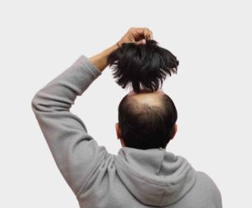 Hair Fixing