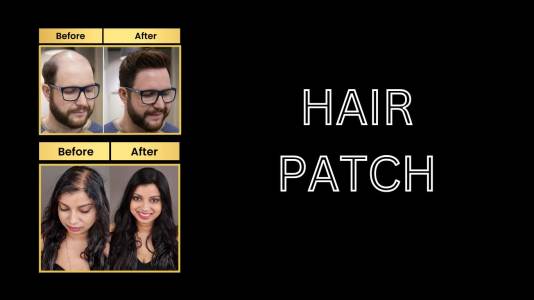 Hair Patch