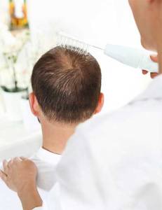 Hair Loss Treatment