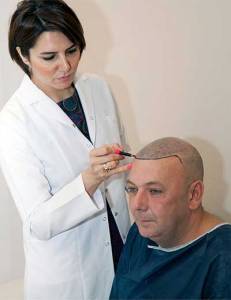 BIO-Hair Transplant