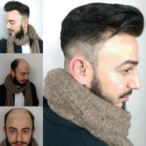 Best Hair Wig Services in Jaipur