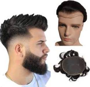 Hair Patch