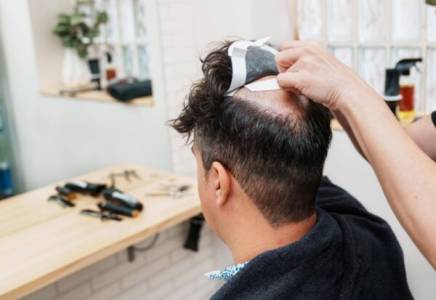 Non Surgical Hair Replacement Service