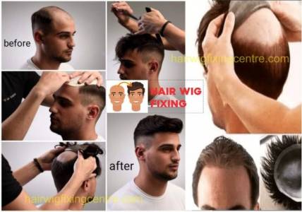 Hair Patch Servicing for Men