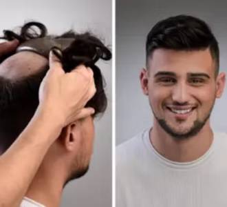 Hair Patch for Men