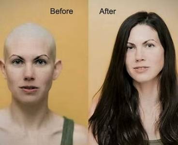 CANCER PATIENT WIG