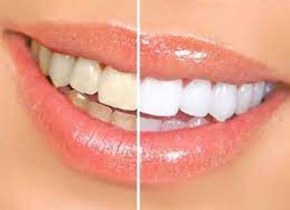 Cosmetic Dentistry