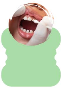 Fluoride Application