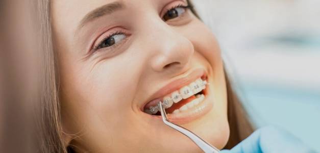 Dental Braces