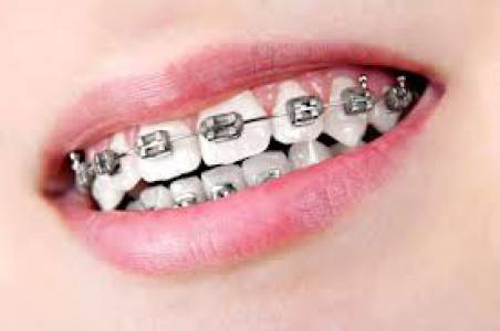 Orthodontics