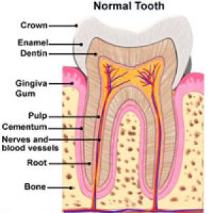 Root Canal Treatment (RCT)