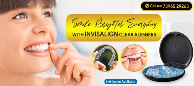 Invisible Braces