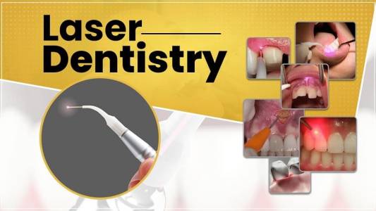 Laser Dentistry