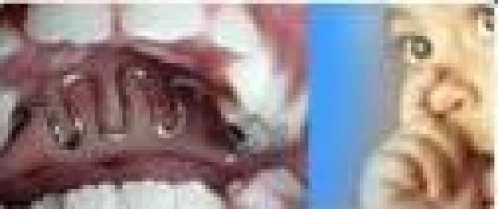 Habit Breaking Appliance