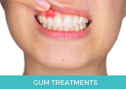 Gum Treatments