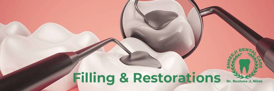Filling and Restorations