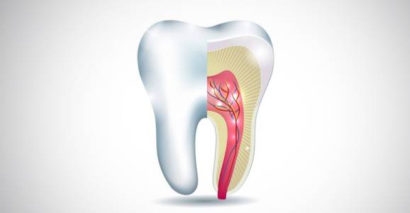 Root Canal Treatment