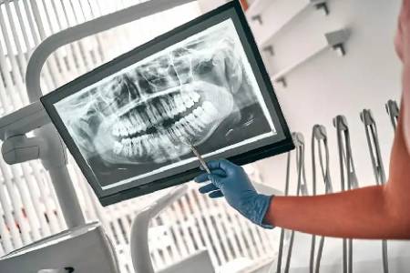 DIGITAL DENTAL X-RAYS