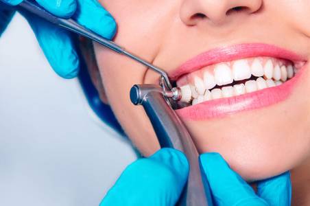 Dental cleaning