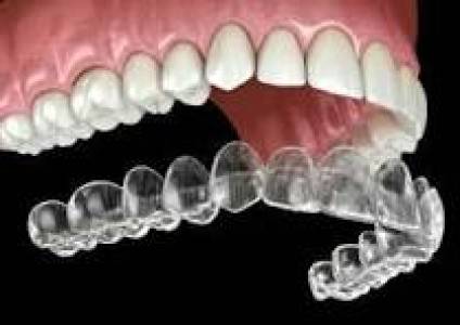 Bridges and Dentures (Prosthodontics)