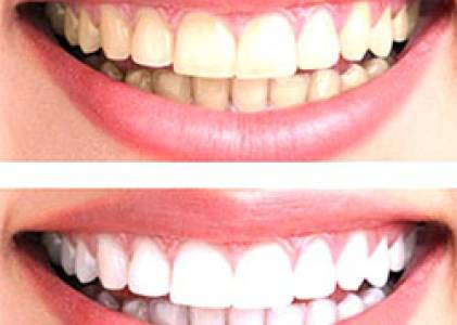 Cosmetic Dentistry