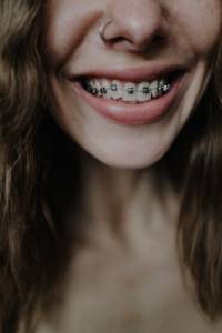 Orthodontic Treatment