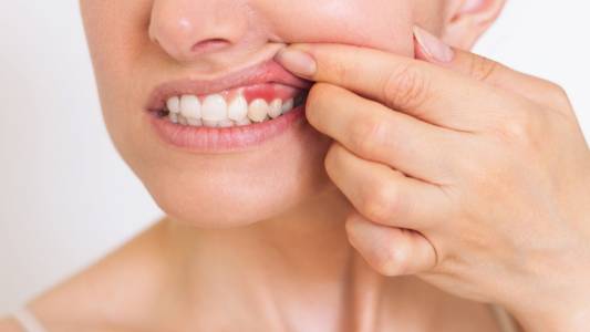 Gum Treatments in Bharuch