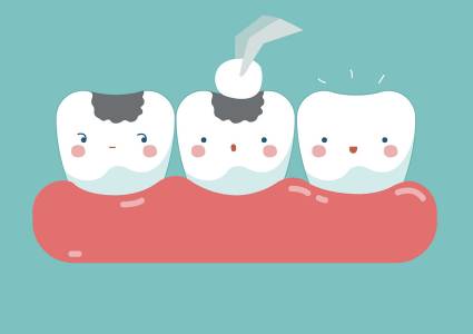 Restorative Dentistry