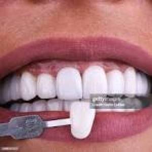 Teeth Whitening