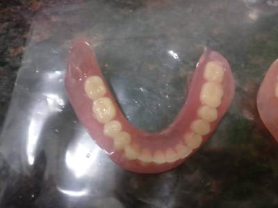 ALIGNERS