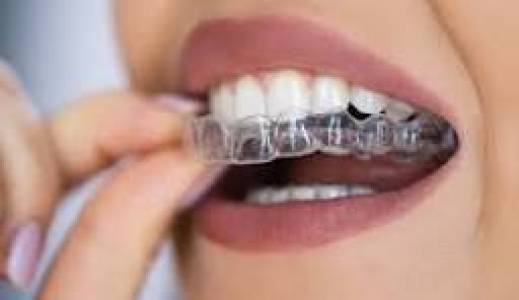 INVISALIGN CLEAR