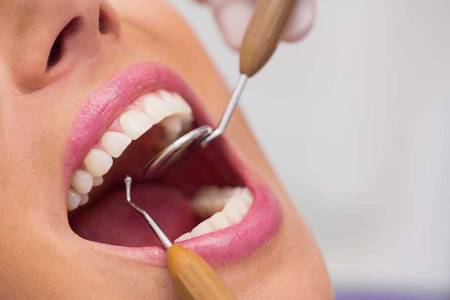 Teeth Cleaning & Polishing Pune