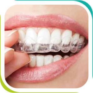 Invisible Orthodontics