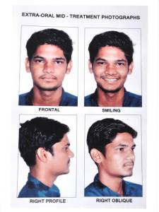 Orthodontic Treatment