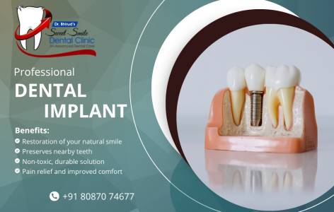 Dental Implants