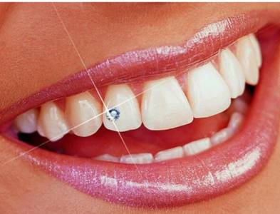 Dental jewellery Pune