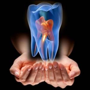 root canal treatment